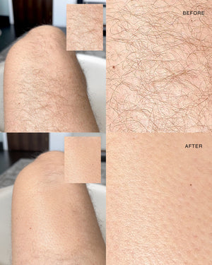 Exfoliating hair removal drop