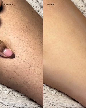 Exfoliating hair removal drop