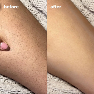 Exfoliating Hair Removal Drop